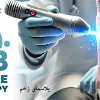  پلاسما تراپی زخم؛ روشی نوین برای درمان زخم و سوختگی