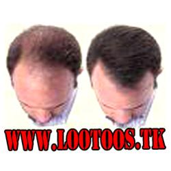  رویش مجددمو (Pretoxan)اورجینال